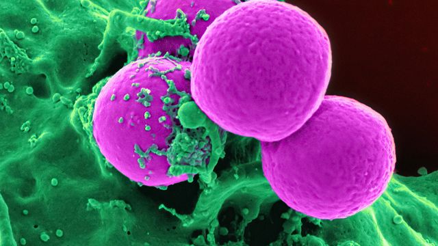 Credit: Pink balls cover green matter. Scanning electron micrograph of MRSA bacteria (purple) interacting with a human neutrophil (green).