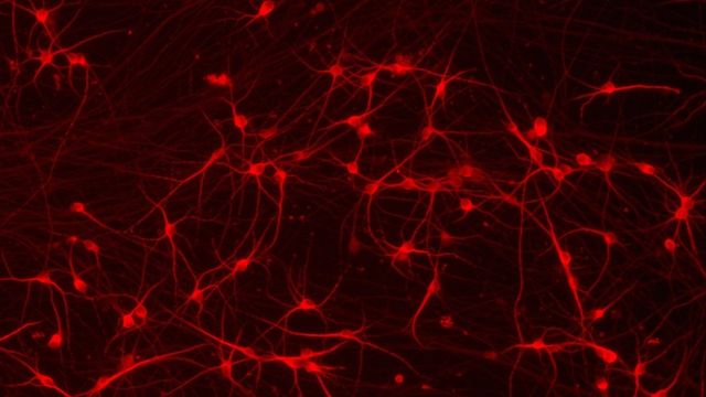 Fluorescent microscopy image of red-stained human neurons showing complex branching structures 