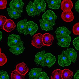 Fluorescent-stained cells under a microscope showing structural details used in flow cytometry analysis. 